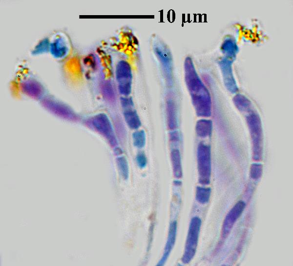 Caloplaca coccinea (Müll. Arg.) Poelt, Dryades Caloplaca coccinea (Müll. Arg.) Poelt