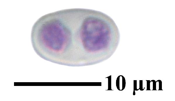 Caloplaca coccinea (Müll. Arg.) Poelt, Dryades Caloplaca coccinea (Müll. Arg.) Poelt