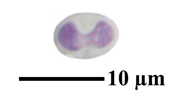 Caloplaca coccinea (Müll. Arg.) Poelt, Dryades Caloplaca coccinea (Müll. Arg.) Poelt