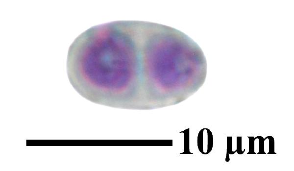 Caloplaca coccinea (Müll. Arg.) Poelt, Dryades Caloplaca coccinea (Müll. Arg.) Poelt