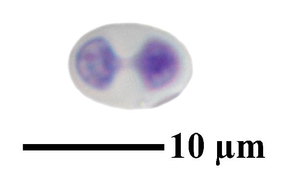 Caloplaca coccinea (Müll. Arg.) Poelt, Dryades Caloplaca coccinea (Müll. Arg.) Poelt