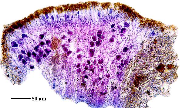 Caloplaca rubelliana (Ach.) Lojka, Dryades Caloplaca rubelliana (Ach.) Lojka