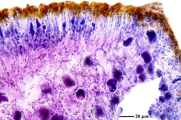 Caloplaca rubelliana (Ach.) Lojka, Dryades Caloplaca rubelliana (Ach.) Lojka
