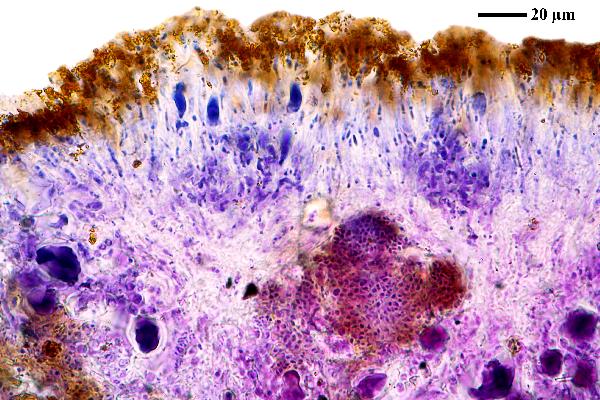 Caloplaca rubelliana (Ach.) Lojka, Dryades Caloplaca rubelliana (Ach.) Lojka
