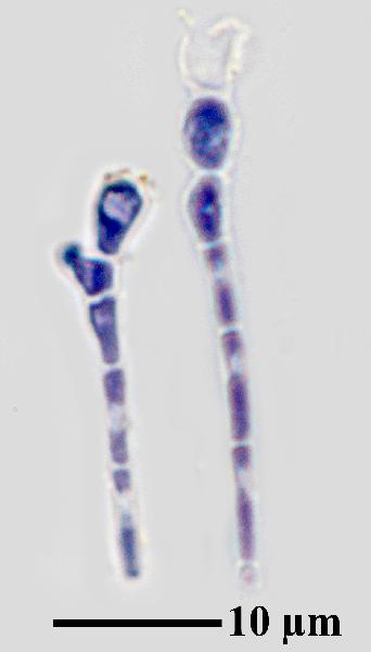 Caloplaca rubelliana (Ach.) Lojka, Dryades Caloplaca rubelliana (Ach.) Lojka